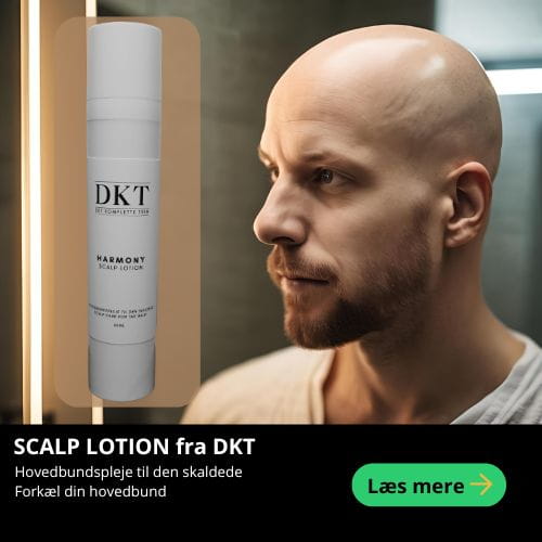 Scalp lotion